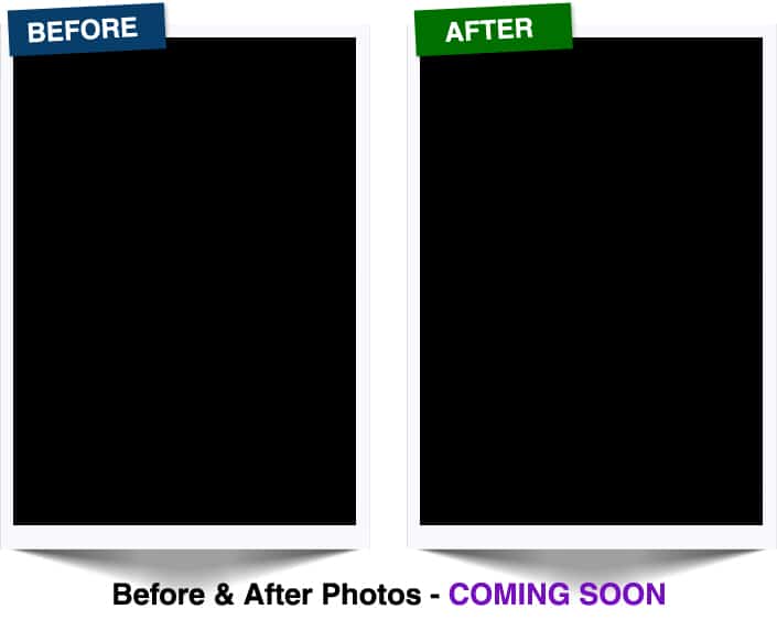 site-Before-After page before after